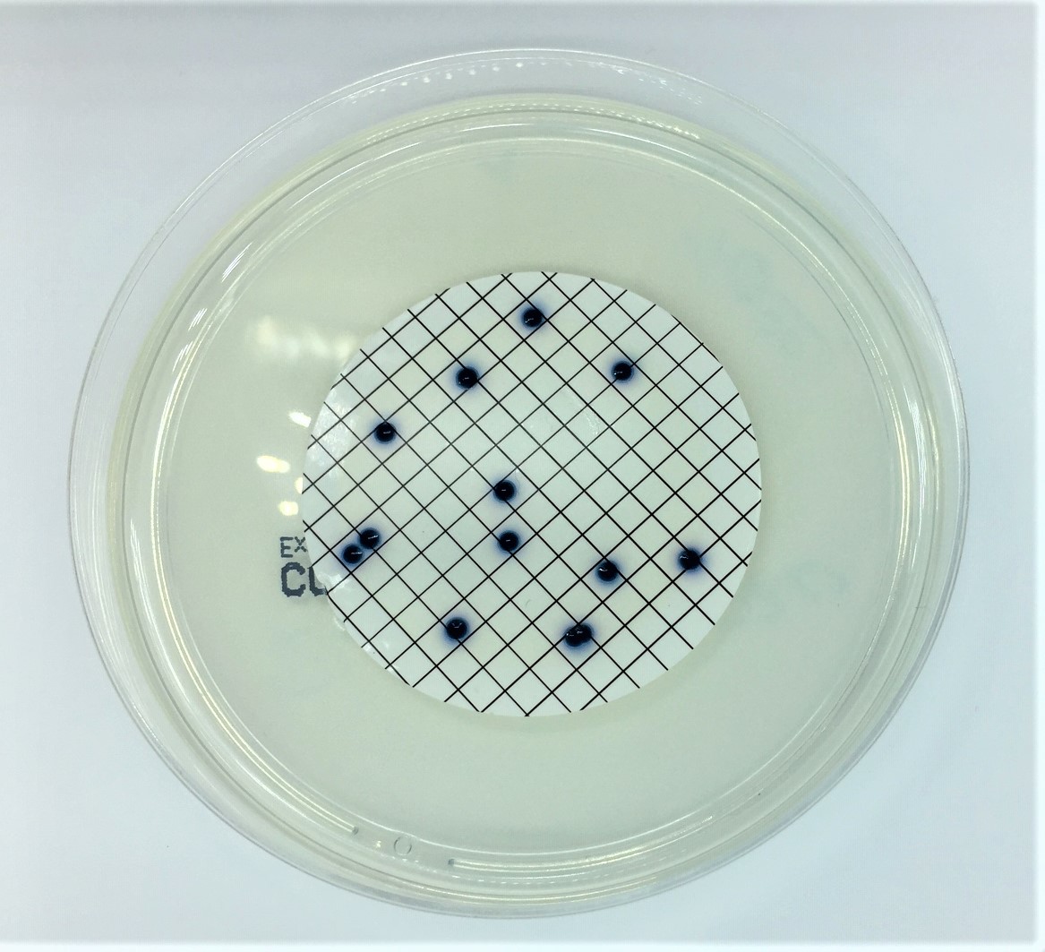 Wasseruntersuchung auf Escherichia coli – Bild 3
