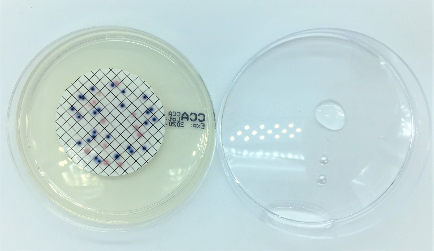 Wasseruntersuchung auf Koloniezahl bei 22 °C und 36 °C, E.coli und coliforme Keime – Bild 3